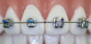 Competitor-Comparison-2